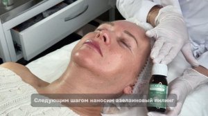 Желтый пилинг GOLDEN YELLOW PEEL в сочетании с Azelaic A15+ и Azelaic A20+