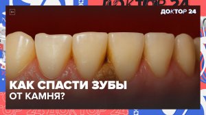 КАК ЧИСТКА ЗУБОВ ДВА РАЗА В ДЕНЬ СПАСАЕТ ОТ ПАРОДОНТИТА И ПОТЕРИ ЗУБОВ? |  Доктор 24