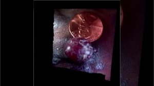 An-innovative-system-for-3D-clinical-photography-in-the-resource-limited-settings-1479-5876-12-169-S