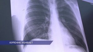 Всемирный день отказа от курения отмечается ежегодно в третий четверг ноября