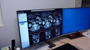 Программа "Главные новости" на 8 канале от 20.11.2025 Часть 2