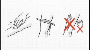 2.7. Первая помощь, спасение жизней