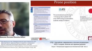 ОРДС Европейские, американские и японские рекомендации Джакомо Беллани