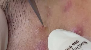 Relax Spa 002 • АСМР • Sac Dep Spa collection • acne