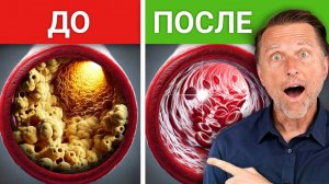 Блюдо №1 для предотвращения инфаркта и инсульта