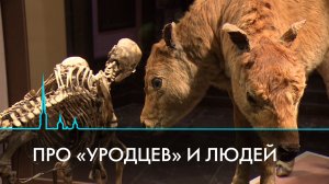 Про «уродцев» и людей. Куда пропала анатомическая коллекция Кунсткамеры?