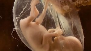 Околоплодные воды плода