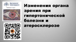 Изменения органа зрения при гипертонической болезни и атеросклерозе