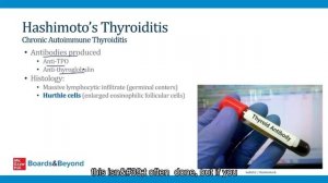 4.Hypothyroidism and Thyroiditis