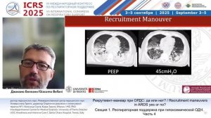 Рекрутмент при ОРДС Джакомо Беллани 2025