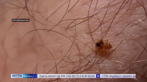 Живучие кровососы: почему российские туристы бегут из египетских отелей?