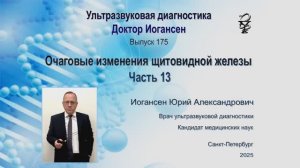 УЗИ. Доктор Иогансен. Выпуск 175. Очаговые изменения щитовидной железы. Часть 13.