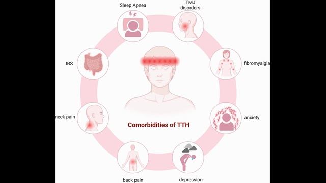 Головная боль напряжения. Признаки первичной головной боли: часть 2
