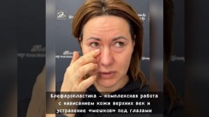 Пластика век блефаропластика)