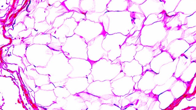 Мезенхимальные и меланоцитарные опухоли. Опухоли нервной системы герминоклеточные опухоли