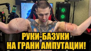 «Руки-Базуки» под угрозой ампутации: последствия лет экспериментов с синтолом