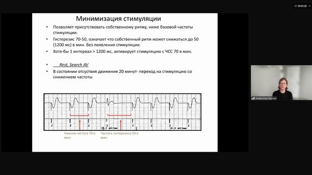 Электрокардиостимуляция: основы программирования