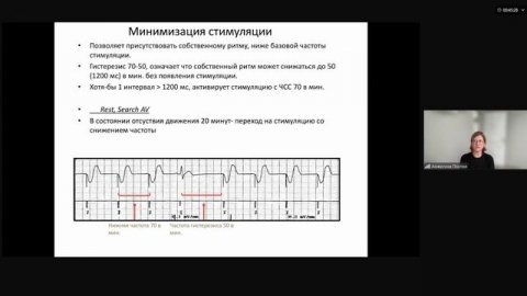 Электрокардиостимуляция: основы программирования