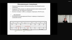 Электрокардиостимуляция: основы программирования