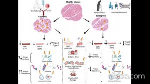 Саркопения и кахексия у пожилых пациентов с онкологическими заболеваниями