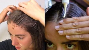 Как правильно мыть голову и навсегда избавиться от перхоти