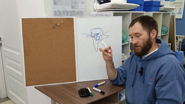 Разновидность межпозвонковых грыж и протрузий