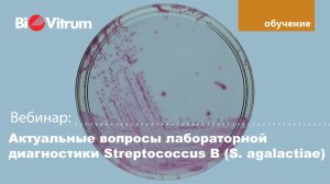 Актуальные вопросы лабораторной диагностики Streptococcus B (S. agalactiae)