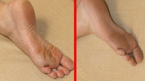 90% женщин не знают, что эти 3 ингредиента сделают пятки как у младенца!