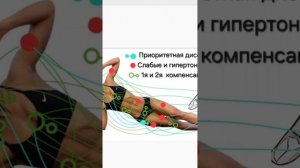 Карта дисфункции. Как все работает..mp4