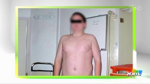 Ребенок толстеет - чтобы его заметили? Жить здорово! Фрагмент выпуска от 24 .11.2025