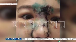 Хозяйка бойцовского пса, который год нападал на детей и изуродовал 6, оказалась на скамье подсудимых