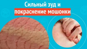 😡 Сильный зуд и покраснение мошонки. Клинический случай №1541