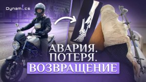 Лишился ноги в аварии. Как адаптироваться после ампутации?