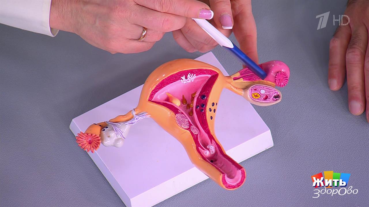 Боль внизу живота: что говорят "часы" вашего тела? Жить здорово! Фрагмент выпуска от 25.11.2025