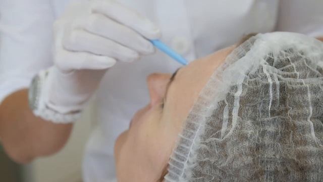 Ботулинотерапия (препарат Диспорт)