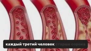 Восстановить сосуды кашей!