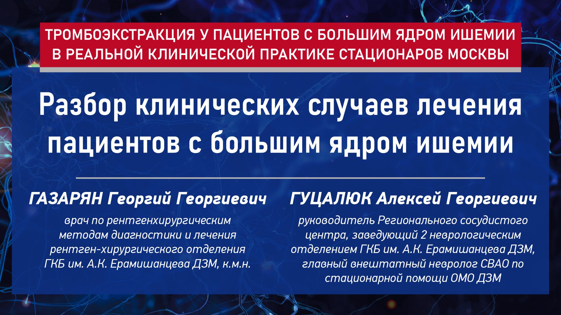 Разбор клинических случаев лечения пациентов с большим ядром ишемии
