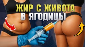 ЖИР с живота можно ПЕРЕСАДИТЬ в ягодицы. Липофилинг ягодиц / Пластический хирург Сергей Свиридов