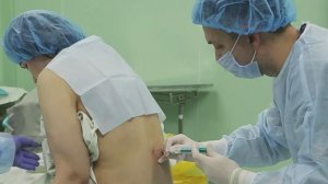 Эпидуральная анестезия во время родов