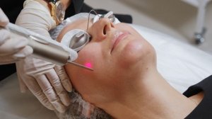 Fоtona омоложение