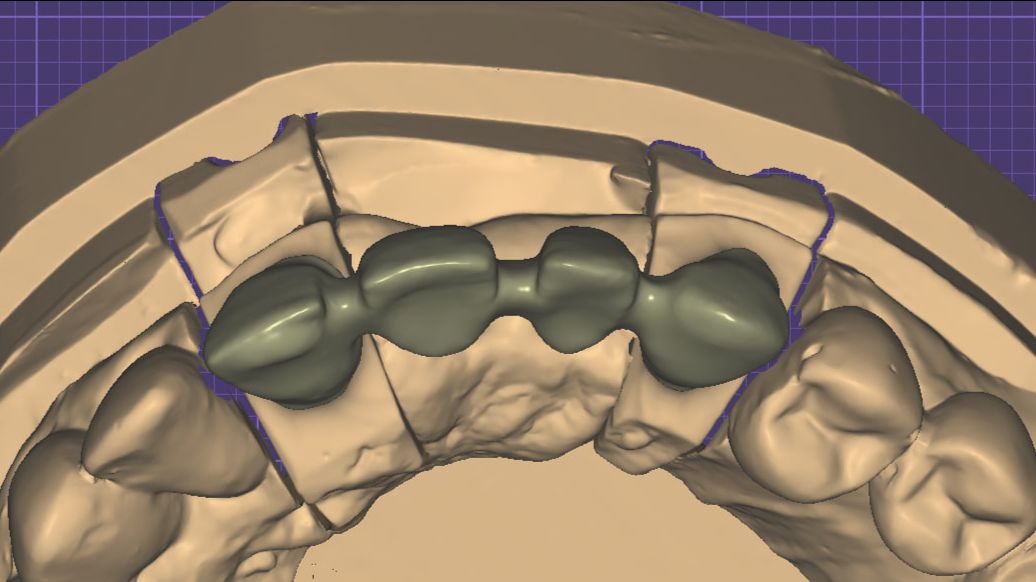 Моделирование каркаса под МК.