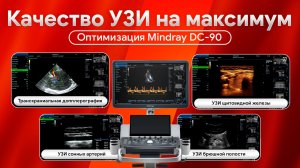 Как улучшить визуализацию на Mindray DC-90: мастер-класс для врачей УЗИ
