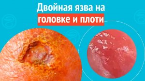 😲 Двойная язва на головке и плоти. Клинический случай №1563