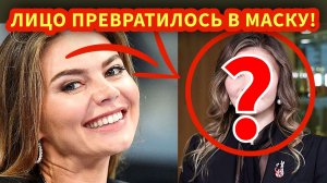 ЖЕРТВА ПЛАСТИКИ: Что хирурги сотворили с Алиной Кабаевой?