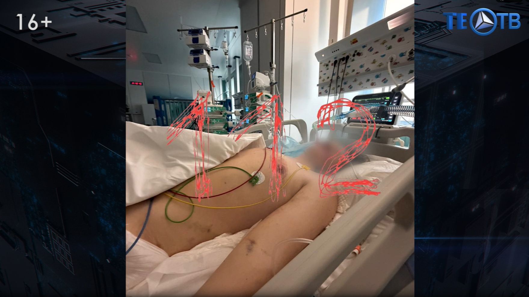 «Комната пыток»: в подмосковном рехабе избивали трудных подростков смотреть онлайн