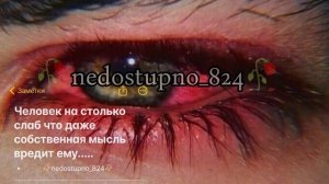 цыганская песня 🎧 душевная 👀🥀ЗЕЛЕНА якха❤️🥀Лёша Лобанов_