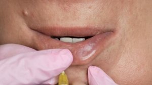 Увеличение губ| Техника плоский бант| Как добиться плоских развернутых губ