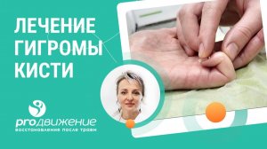🩺  Лечение гигромы кисти