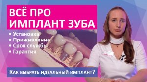Все про зубной имплант. Цена зубного импланта. За что вы платите? Какая методика имплантации лучше?