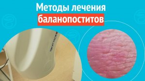 ✅ Методы лечения баланопоститов. Клинический случай №1593
